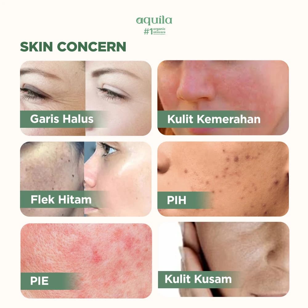 Dazzling Glow Vitamin C Barrier Serum - Serum Anti Aging yang Mencerahkan Wajah & Menyamarkan Bekas Jerawat thumbnail 3
