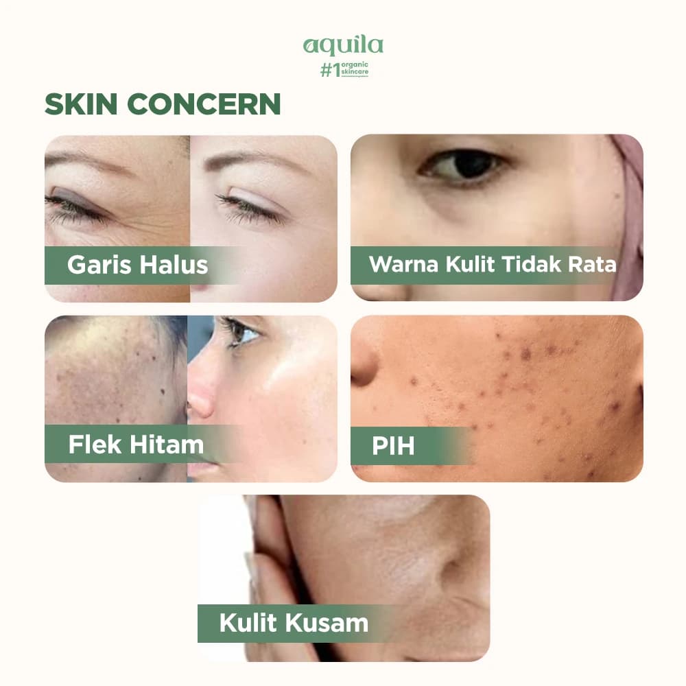 Brightening C+ Serum - Mencerahkan & Menyamarkan Flek Hitam thumbnail 3
