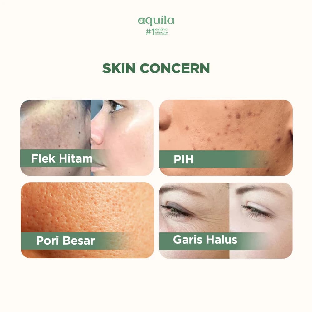 Brightening Natural Soap Kojic - Sabun Badan dan Wajah Mencerahkan Melembapkan Kulit thumbnail 5