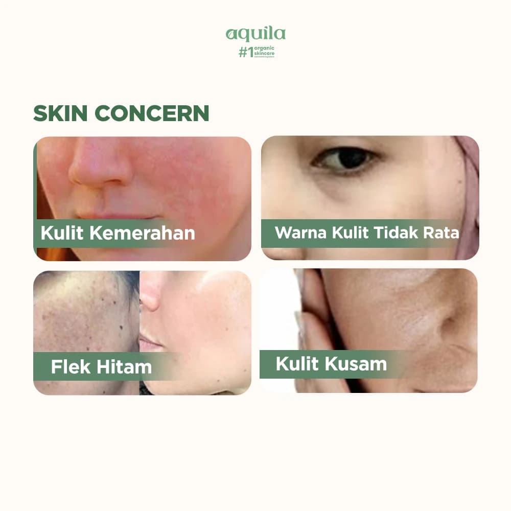 Treatment Flek Hitam Bundling - Paket Brightening Wajah dan Badan thumbnail 3