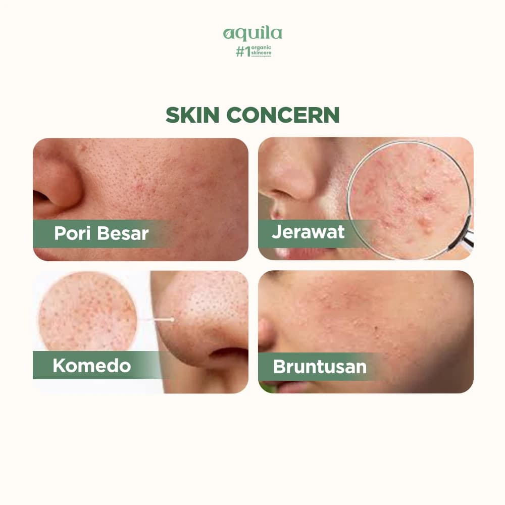 Normal to Oily Skin Trial Set - Perawatan Kulit Normal, Berminyak, dan Jerawat thumbnail 3