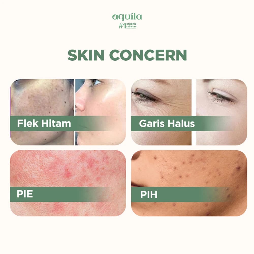 Day & Night Cream Moisturizer - Cream Moisturizer untuk Melembapkan Kulit Wajah thumbnail 3