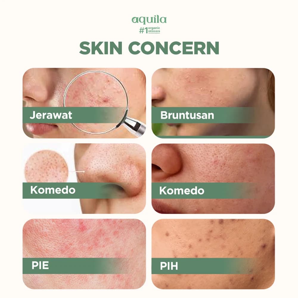 Best Duo Oily - Serum dan Cleansing Balm untuk Perawatan Kulit Berminyak thumbnail 3