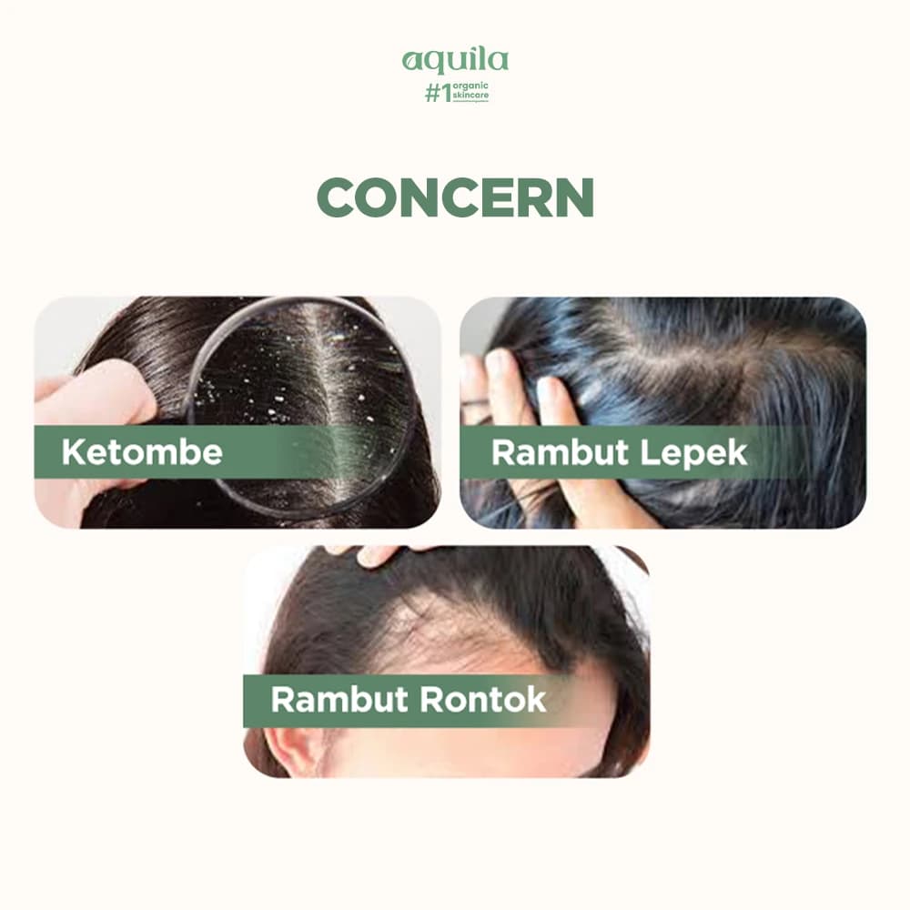 Hair Care Bundle - Hair Care untuk Merawat dan Menjaga Rambut Anti Ketombe dan Bau thumbnail 5